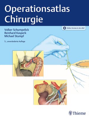 cover image of Operationsatlas Chirurgie